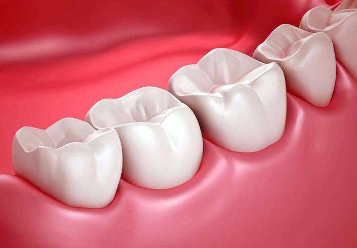 牙齿弓型矫正（牙齿矫正牙弓）(图3)