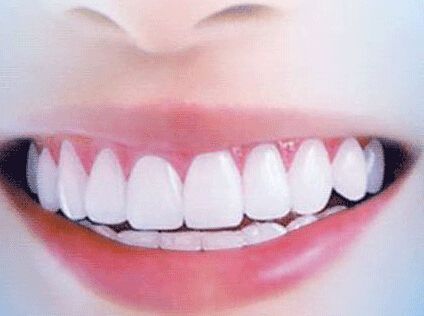 牙掉完多久能镶牙（牙齿掉后多长时间可以镶牙）(图3)