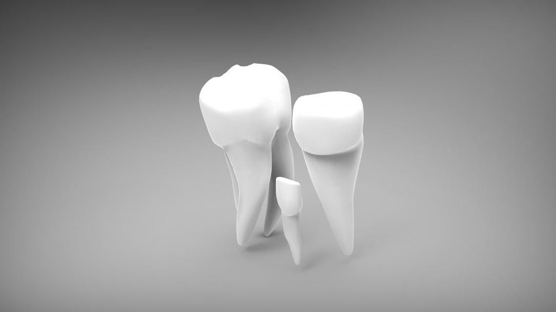 考研考试带种植牙齿-考研考试带金属牙齿(图3)
