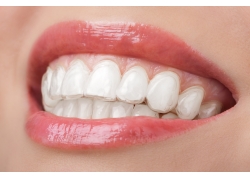 南京种牙专家推荐哪家好-南京种牙价格一般多少钱一颗(图2)