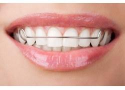 牙齿矫正正面脸型变化图（牙齿矫正前后脸对比照侧面）(图1)