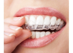大连种植牙齿时间安排多久-大连种植牙齿多少钱一颗?(图3)