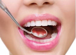 牙齿美白三种材料（牙齿美白的材料都有哪些）(图2)