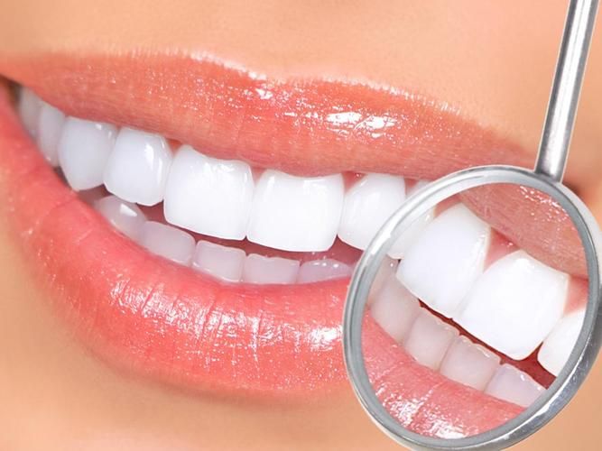 矫正牙齿需要多久恢复好-矫正牙齿需要多久才有效果(图3)