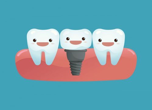 矫正牙齿有什么形态要求-矫正牙齿有几种(图1)
