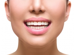 矫正牙齿有什么形态要求-矫正牙齿有几种(图3)