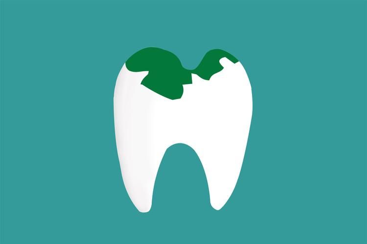 牙齿矫正图片视频-牙齿矫正图示(图1)