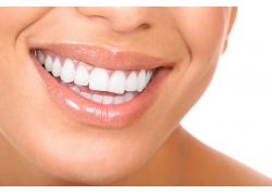 矫正牙齿牙洞多以能合-正畸牙洞什么时候开始收?(图1)