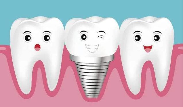 矫正牙齿牙洞多以能合-正畸牙洞什么时候开始收?(图2)
